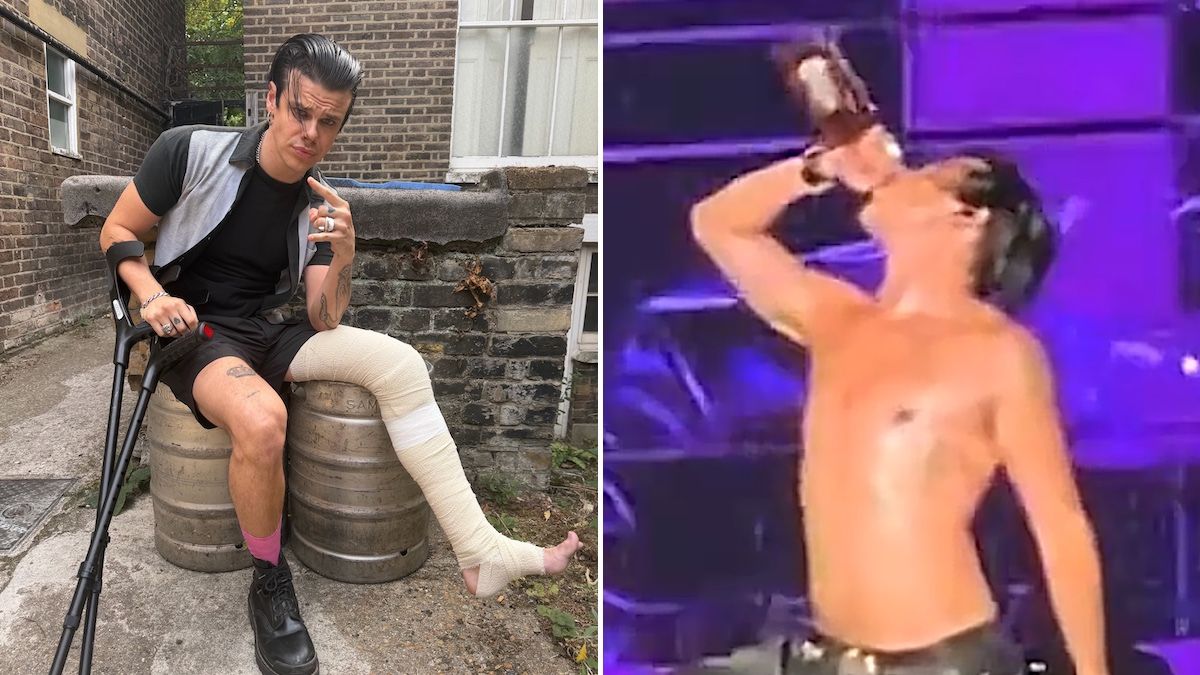 Featured image Yungblud Injured in Dirt Bike Crash Keeps Touring with Jack Daniels
